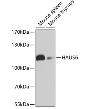 HAUS6 Rabbit Polyclonal Antibody