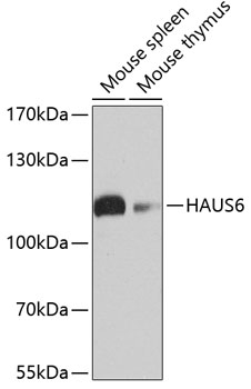 HAUS6 Rabbit Polyclonal Antibody