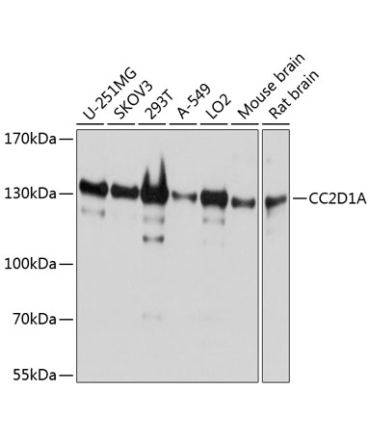 CC2D1A Rabbit Polyclonal Antibody