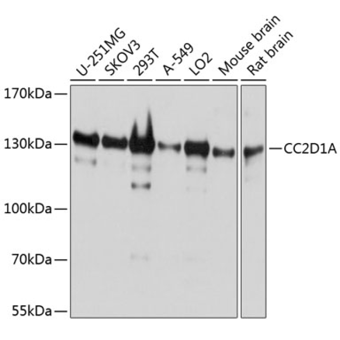 CC2D1A Rabbit Polyclonal Antibody