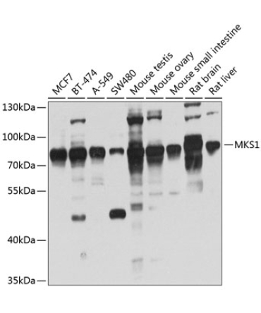 MKS1 Rabbit Polyclonal Antibody