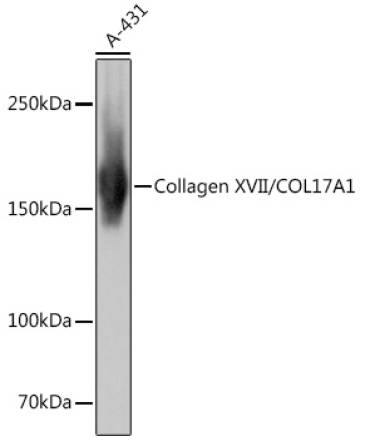Collagen XVII/COL17A1 Rabbit Monoclonal Antibody