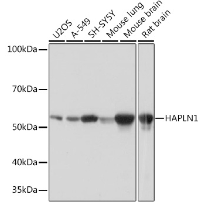 HAPLN1 Rabbit Monoclonal Antibody