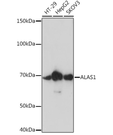 ALAS1 Rabbit Monoclonal Antibody