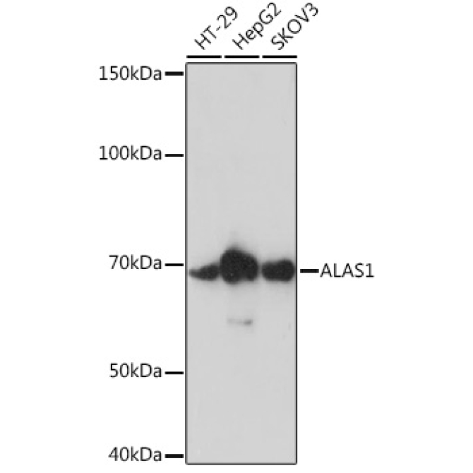ALAS1 Rabbit Monoclonal Antibody