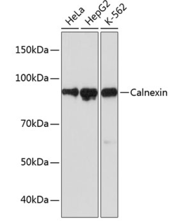 Calnexin Rabbit Monoclonal Antibody