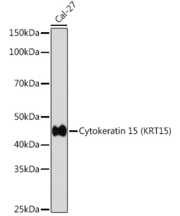 Cytokeratin 15 (KRT15) Rabbit Monoclonal Antibody