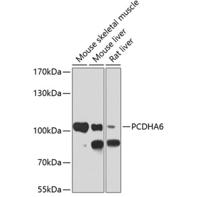PCDHA6 Rabbit Polyclonal Antibody