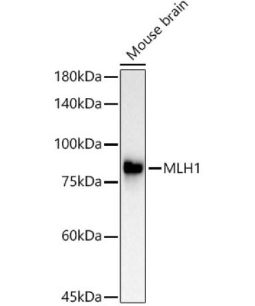 MLH1 Rabbit Monoclonal Antibody [KO Validated]