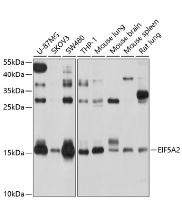 EIF5A2 Rabbit Polyclonal Antibody
