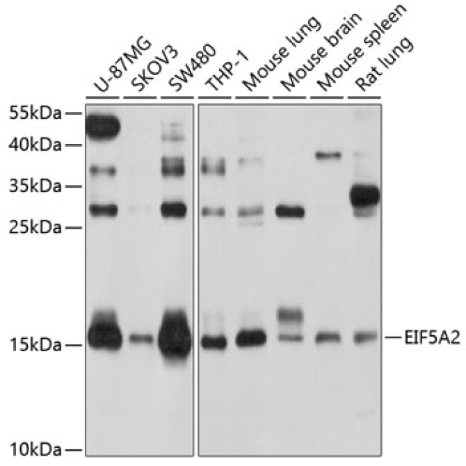 EIF5A2 Rabbit Polyclonal Antibody