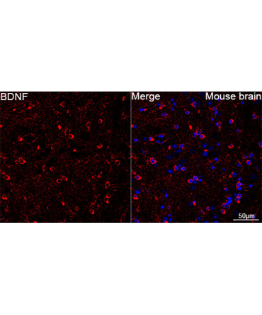 BDNF Rabbit Monoclonal Antibody