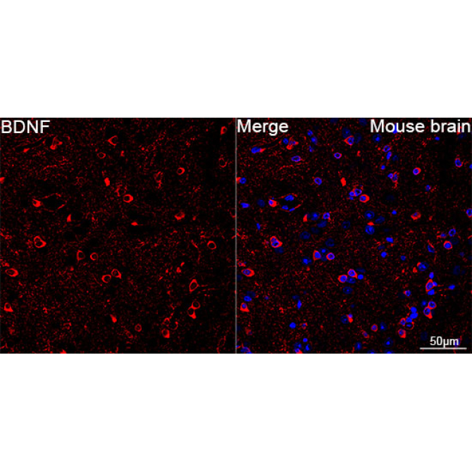 BDNF Rabbit Monoclonal Antibody