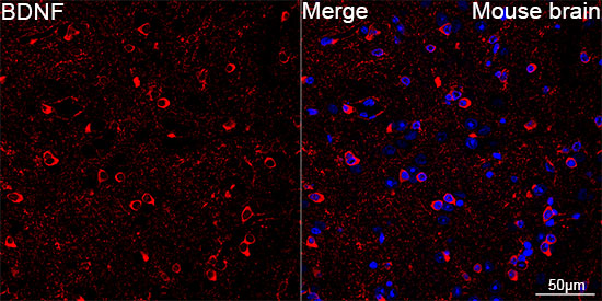 BDNF Rabbit Monoclonal Antibody