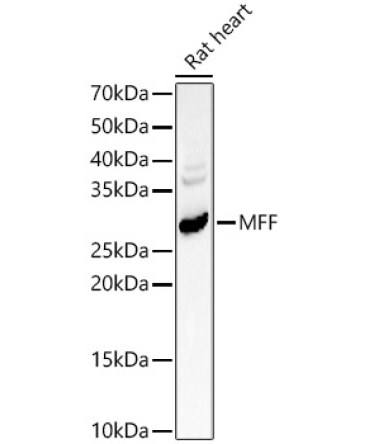 MFF Rabbit Polyclonal Antibody