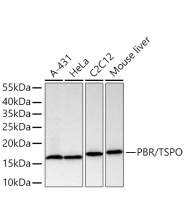PBR/TSPO Rabbit Monoclonal Antibody