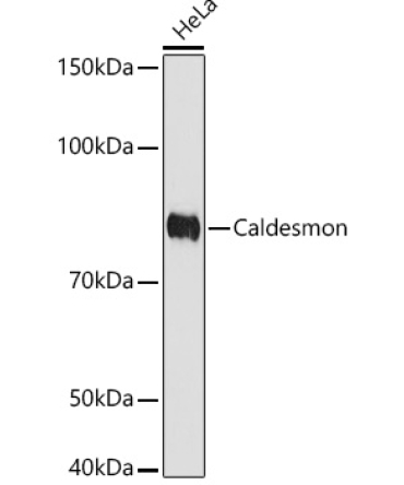 Caldesmon Rabbit Monoclonal Antibody