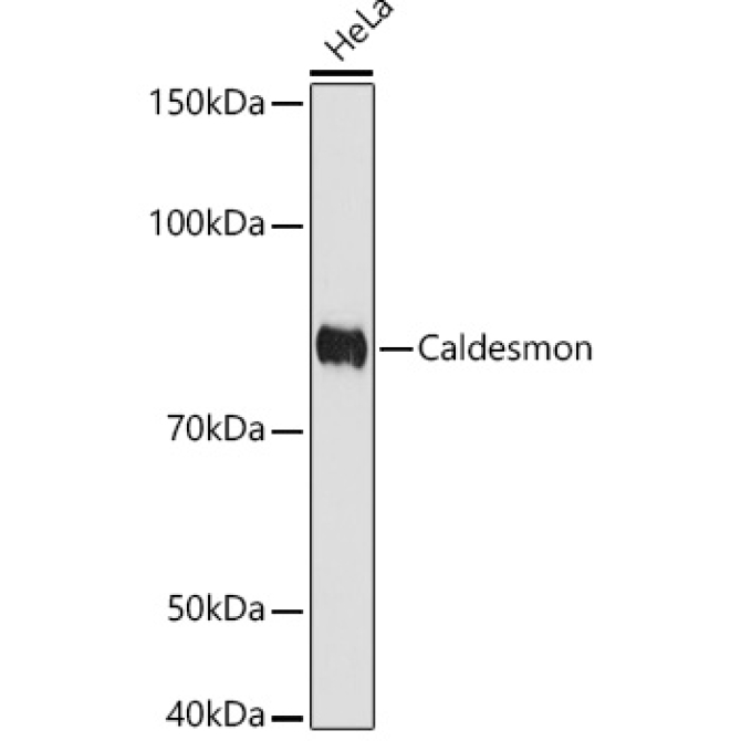 Caldesmon Rabbit Monoclonal Antibody
