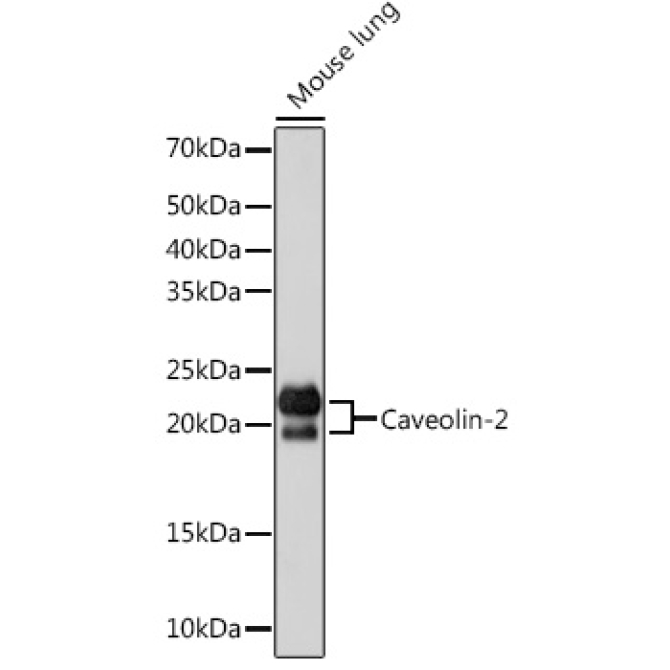 Caveolin-2  Rabbit Monoclonal Antibody