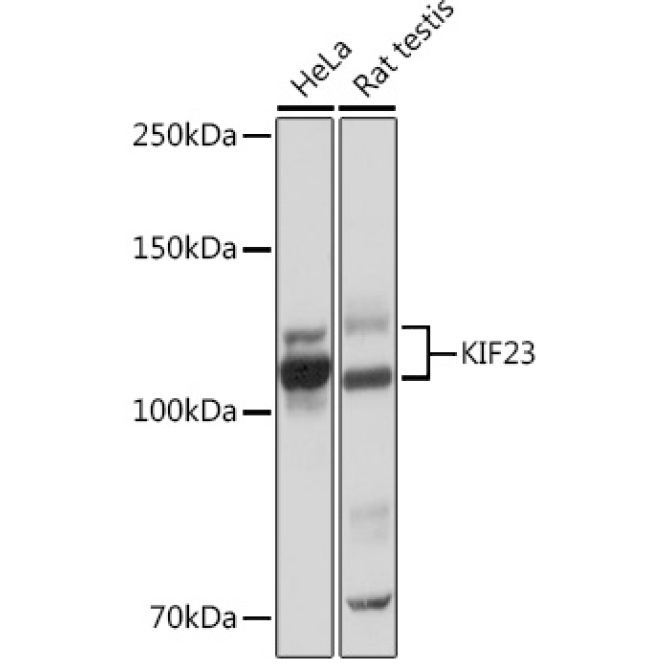 KIF23 Rabbit Monoclonal Antibody