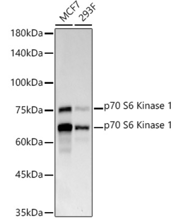 p70 S6 Kinase 1 Rabbit Monoclonal Antibody
