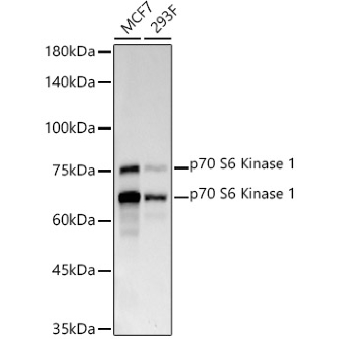 p70 S6 Kinase 1 Rabbit Monoclonal Antibody