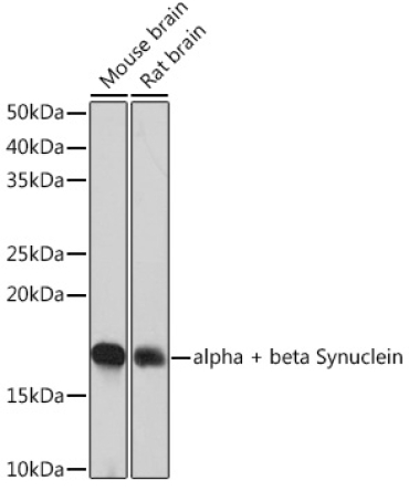 alpha + beta Synuclein Rabbit Monoclonal Antibody