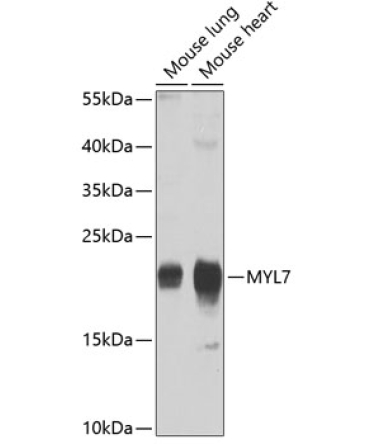 MYL7 Rabbit Polyclonal Antibody