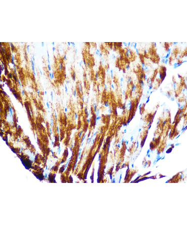Cardiac troponin T (TNNT2) Rabbit Monoclonal Antibody