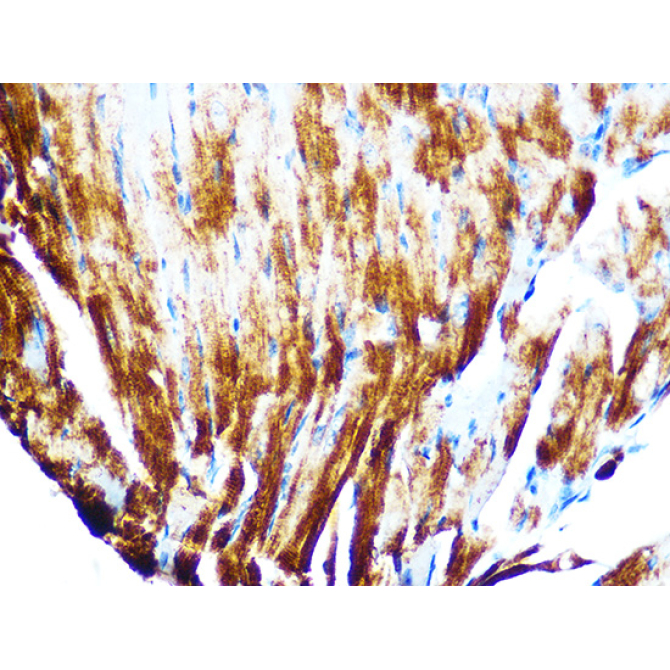 Cardiac troponin T (TNNT2) Rabbit Monoclonal Antibody