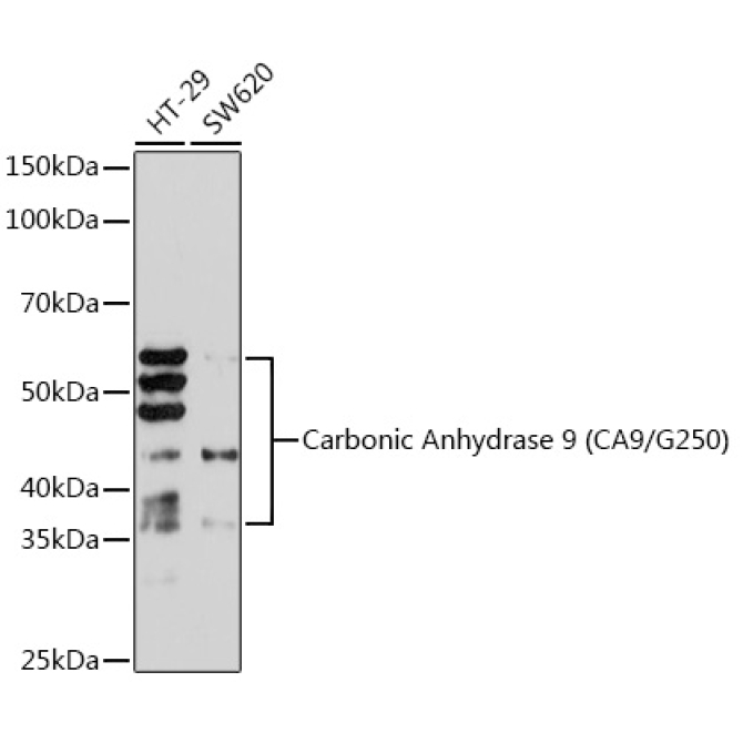 Carbonic Anhydrase 9 (CA9/G250) Rabbit Monoclonal Antibody