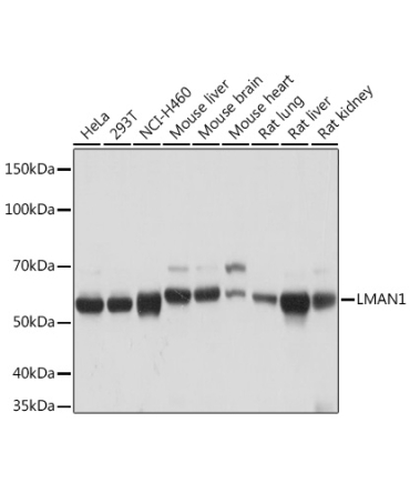 LMAN1 Rabbit Monoclonal Antibody