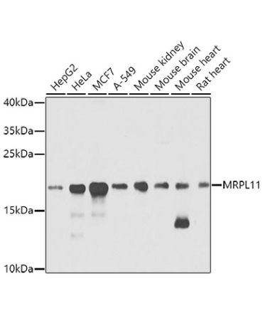 MRPL11 Rabbit Polyclonal Antibody
