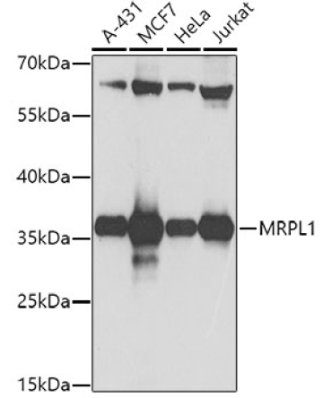 MRPL1 Rabbit Polyclonal Antibody