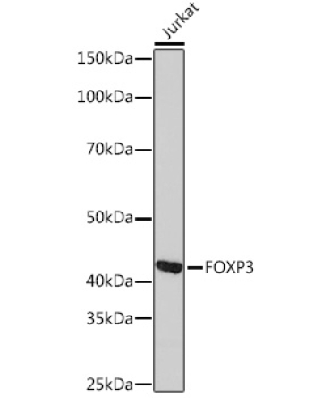 FOXP3 Rabbit Monoclonal Antibody