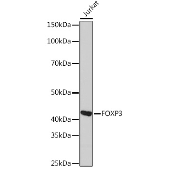 FOXP3 Rabbit Monoclonal Antibody