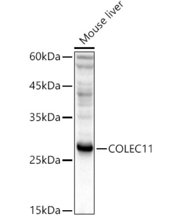 COLEC11 Rabbit Polyclonal Antibody