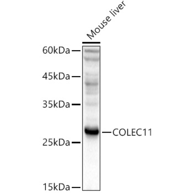 COLEC11 Rabbit Polyclonal Antibody