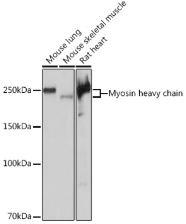 Myosin heavy chain Rabbit Monoclonal Antibody