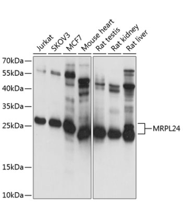 MRPL24 Rabbit Polyclonal Antibody
