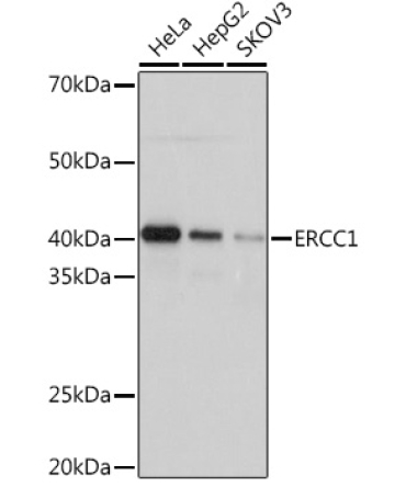 ERCC1 Rabbit Monoclonal Antibody