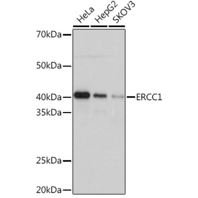 ERCC1 Rabbit Monoclonal Antibody