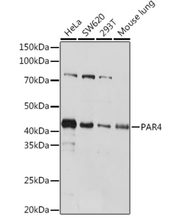 PAR4 Rabbit Monoclonal Antibody