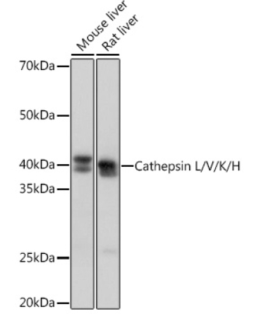 Cathepsin L/V/K/H Rabbit Monoclonal Antibody