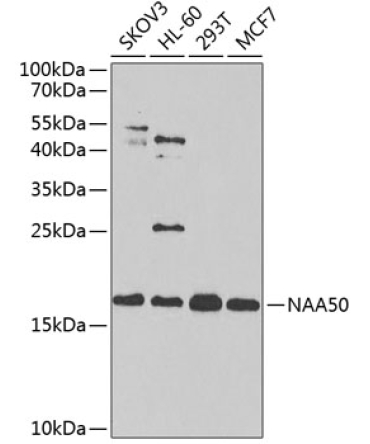 NAA50 Rabbit Polyclonal Antibody