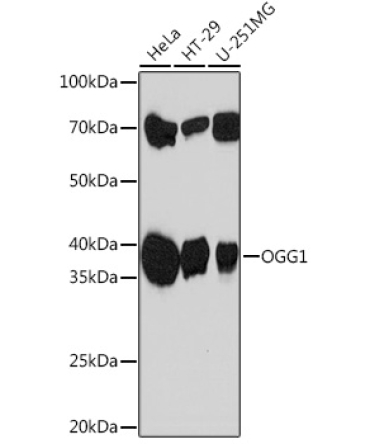 OGG1 Rabbit Monoclonal Antibody