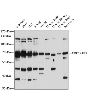 CDK5RAP3 Rabbit Polyclonal Antibody
