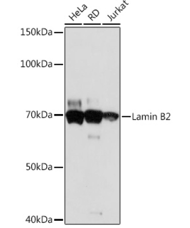 Lamin B2 Rabbit Monoclonal Antibody
