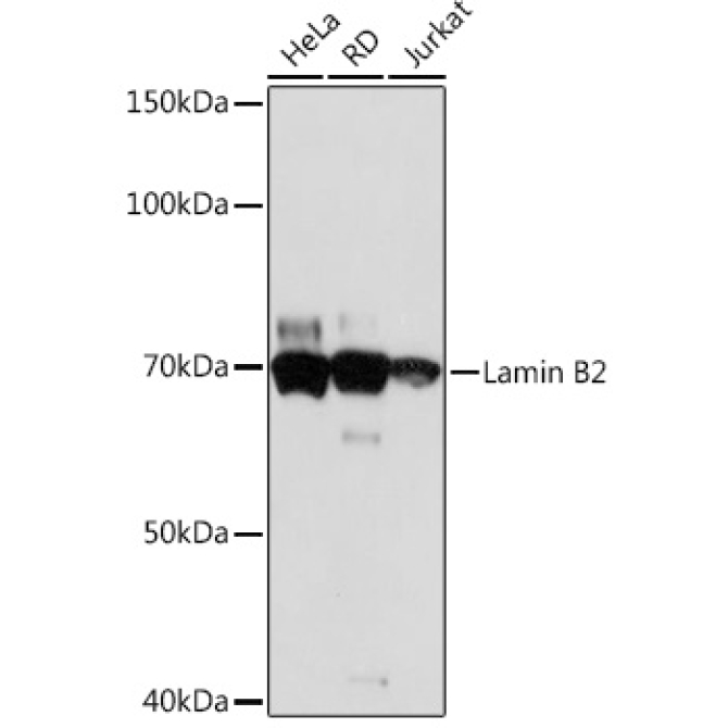 Lamin B2 Rabbit Monoclonal Antibody
