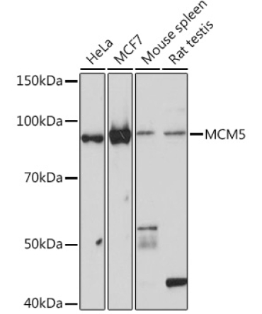 MCM5 Rabbit Monoclonal Antibody